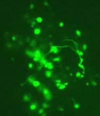 Neuronas y neuritas regeneradas in vitro marcados con anti-neurofilamentos 200K.
