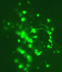 Neurons and neurite regenerated in vitro labeled with 200K anti-neurofilaments.