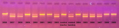 Imagen de una electroforesis en agarosa de la amplificación por PCR del gen CHD que permite sexar aves.