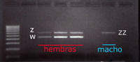 Electrophoresis gel for the sexing of 4 individuals: 3 females and 1 male.