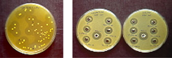 Cultivo de bacterias lácticas y actividad antimicrobiana de las bacteriocinas.