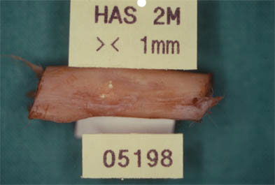 Bone piece of study where a correct integration of the studied biomaterial is observed macroscopically.