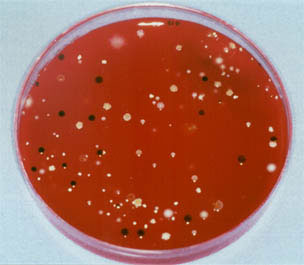 Growth of colonies taken at 48 hours of treatment of a lower third molar