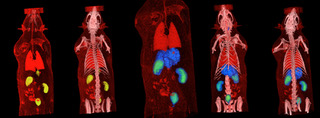 PET-CT image