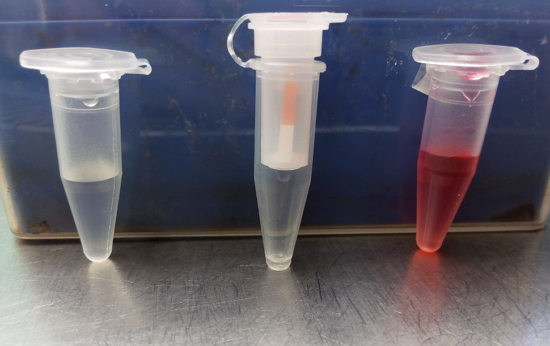 Samples taken from patients for analysis by immunoassay techniques. Left to right: saliva sample, sample taken with Periopaper, plasma sample.