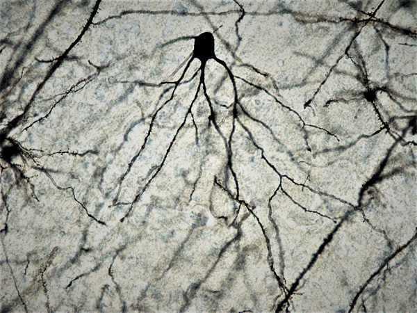 Neurona de cerebro de ratón a 100x tras tinción de Golgi-Cox. / Facultad de Medicina UCM. 