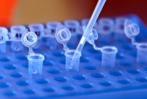 Los científicos han usado técnicas de secuenciación genética en las muestras de sangre de las pacientes. / SNRE.