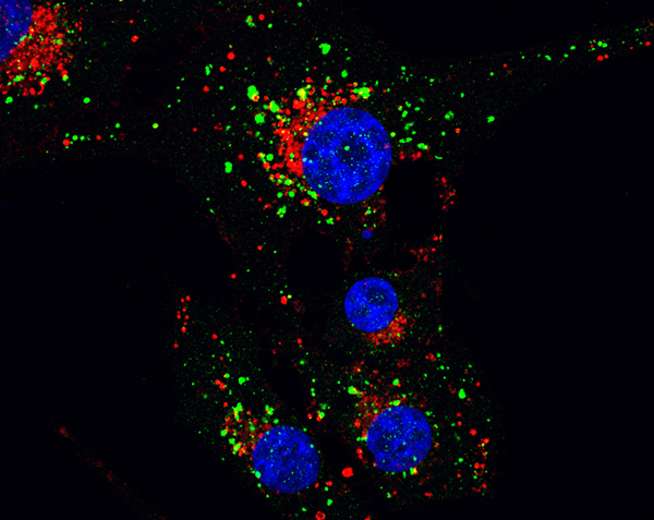 Efecto del tratamiento con THC en los autofagosomas (verde) y lisosomas (rojo) de células de glioma. Autora: Sonia Hernández.