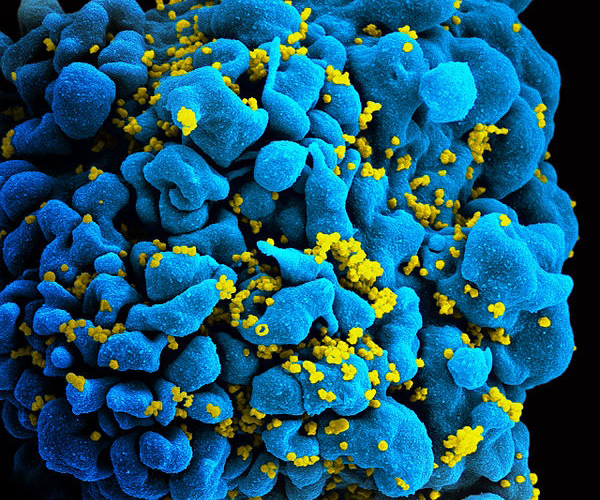 Partículas de VIH infectando a un linfocito T. / National Institutes of Health (NIH).