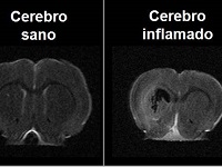 “¿Pueden algunos derivados de la marihuana curar enfermedades como Alzheimer, Parkinson o esclerosis múltiple sin “colocar” a los pacientes?”