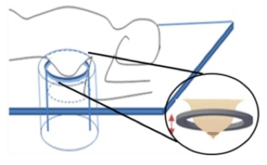 Representación esquemática de un sistema de Tomografía por Ultrasonidos (USCT). Se observa de la cuba de agua donde se introduce la mama rodeada de un anillo de transductores que realizan adquisiciones hasta conseguir la imagen 3D de la mama completa. (Fuente: Tesis Doctoral de Mailyn Pérez Liva, 2017)