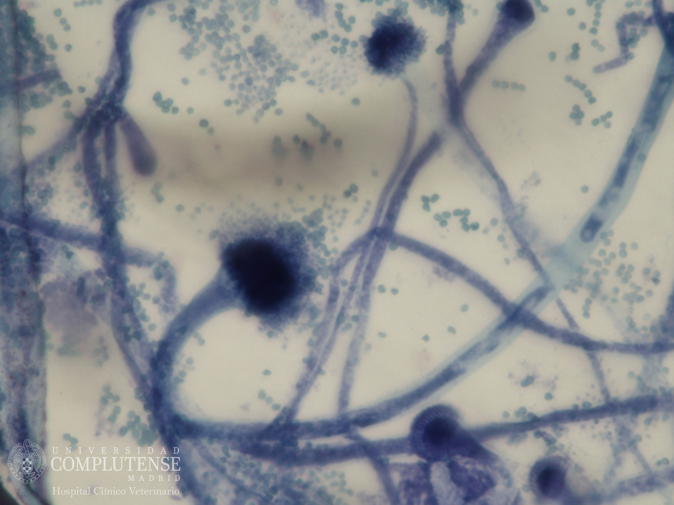 Lavado broncoalveolar de un perro con megaesófago. Imagen microscópica de Aspergillus fumigatus. Tinción con Azul de Metileno.