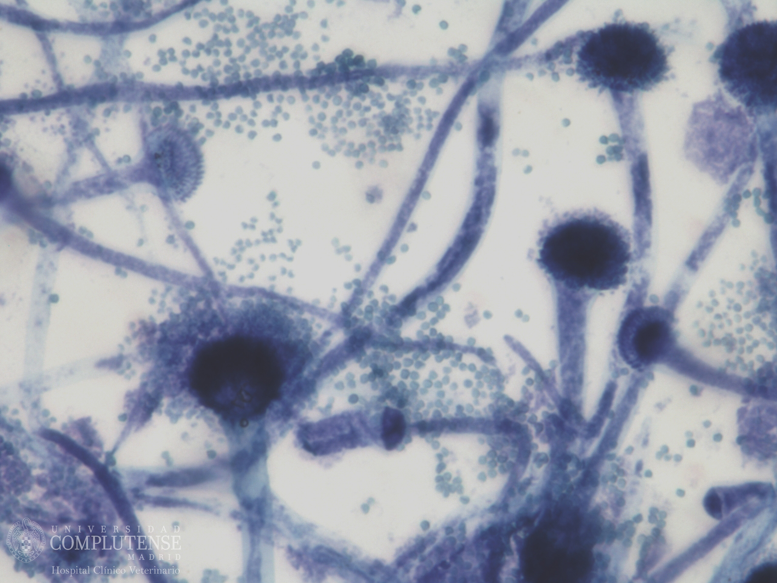 Lavado broncoalveolar de un perro con megaesófago. Imagen microscópica de Aspergillus fumigatus Tinción con Azul de Metileno.