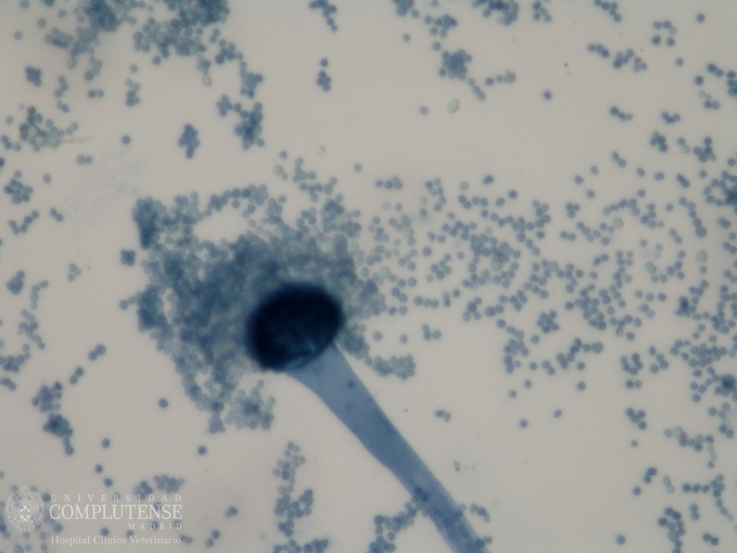 Lavado broncoalveolar de un perro con megaesófago. Imagen microscópica de Aspergillus fumigatus. Tinción con Azul de Metileno.