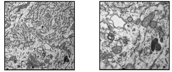 Las imágenes corresponden a motoneuronas de la médula espinal de animales tratados, las cuales presentan fragmentación del retículo endoplásmico y desorganización mitocondrial.