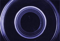 Chemical reaction in agarose gel with formation of precipitates of calcium phosphate.