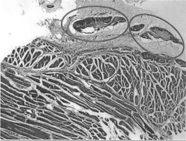 Tinción de hematoxilina-eosina realizada en muestras obtenidas tras 3 semanas de implantación de los hidrogeles sin rhBMP-2 (10x).