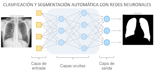 Clasificación y segmentación automática con redes neuronales