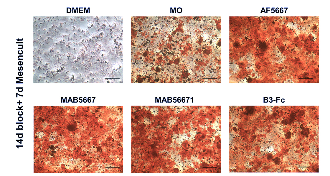 Imágenes representativas de la diferenciación osteogénica de MSC humanas tras 21 días totales de cultivo, tratadas con diferentes bloqueantes del receptor EphB3 y teñidas con un colorante de calcio (Alizarin Red) (100X, escala = 200μm). Se observa la mayor capacidad de diferenciación ósea de las MSC tratadas, comparadas con las células control (DMEM y MO).