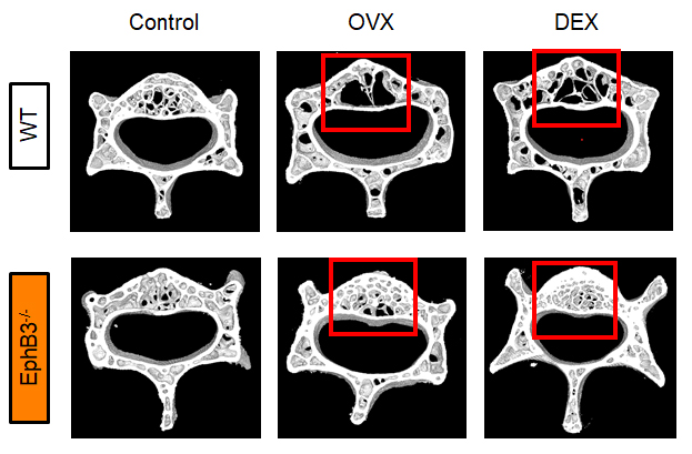 Imágenes representativas de las reconstrucciones por microCT de la segunda vértebra lumbar de ratones sin modificaciones (WT) y ratones EphB3-/- sin tratamiento (Control), ovariectomizados (OVX) y tratados con dexametasona (DEX). En los recuadros rojos se puede comparar la zona de trabéculas óseas de los animales WT (muy afectados) y de los EphB3-/- (no alterados)