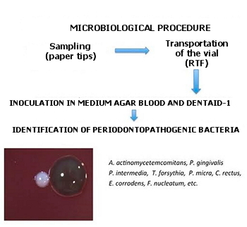 Scheme of the processing of clinical samples of subgingival bacterial plaque for microbiological diagnosis.