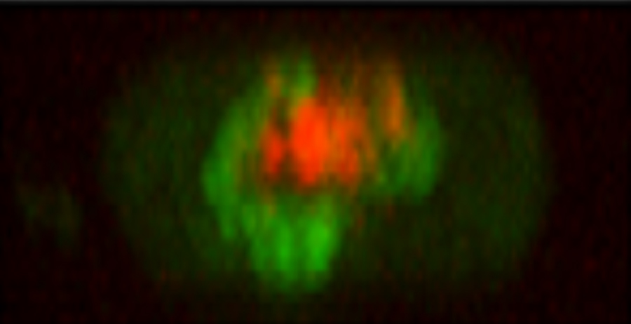 Topography of the NK cell Immune synapse Interface. cSMAC red and pSMAC green. Roda-Navarro et al. J. Immunol 2004