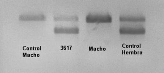 Imágenes de ADN en gel de agarosa