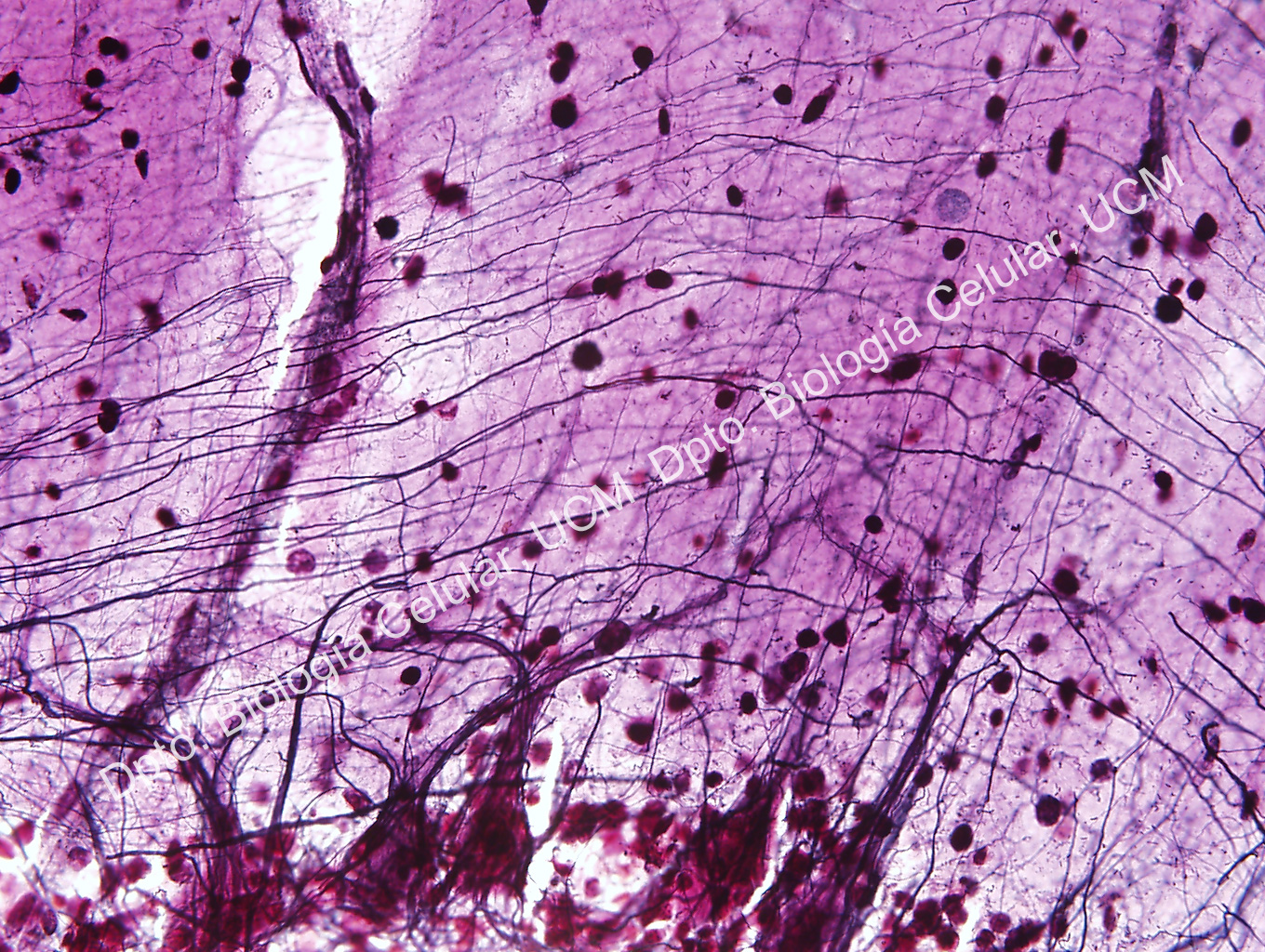 Neuronas
