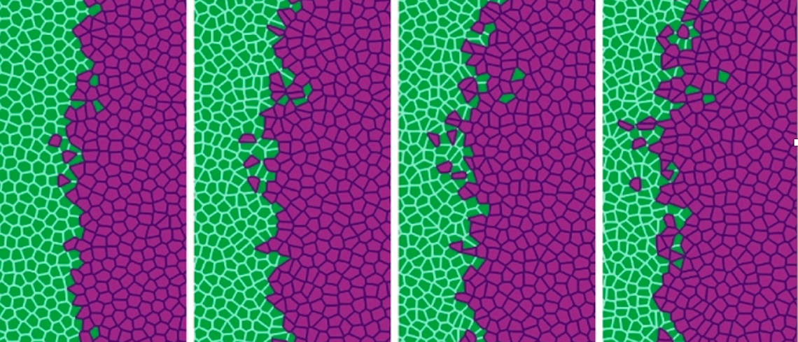Un estudio describe matemáticamente cómo empieza la metástasis