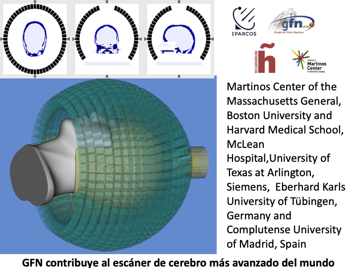 El GFN participa en el desarrollo del escáner PET/MRI para cerebro más avanzado del mundo