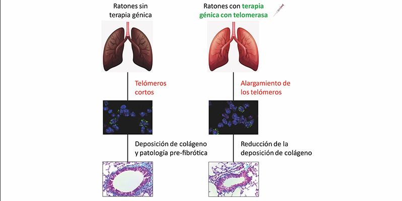 Investigadores del CNIO abren una vía hacia una futura terapia génica contra la fibrosis pulmonar asociada al envejecimiento