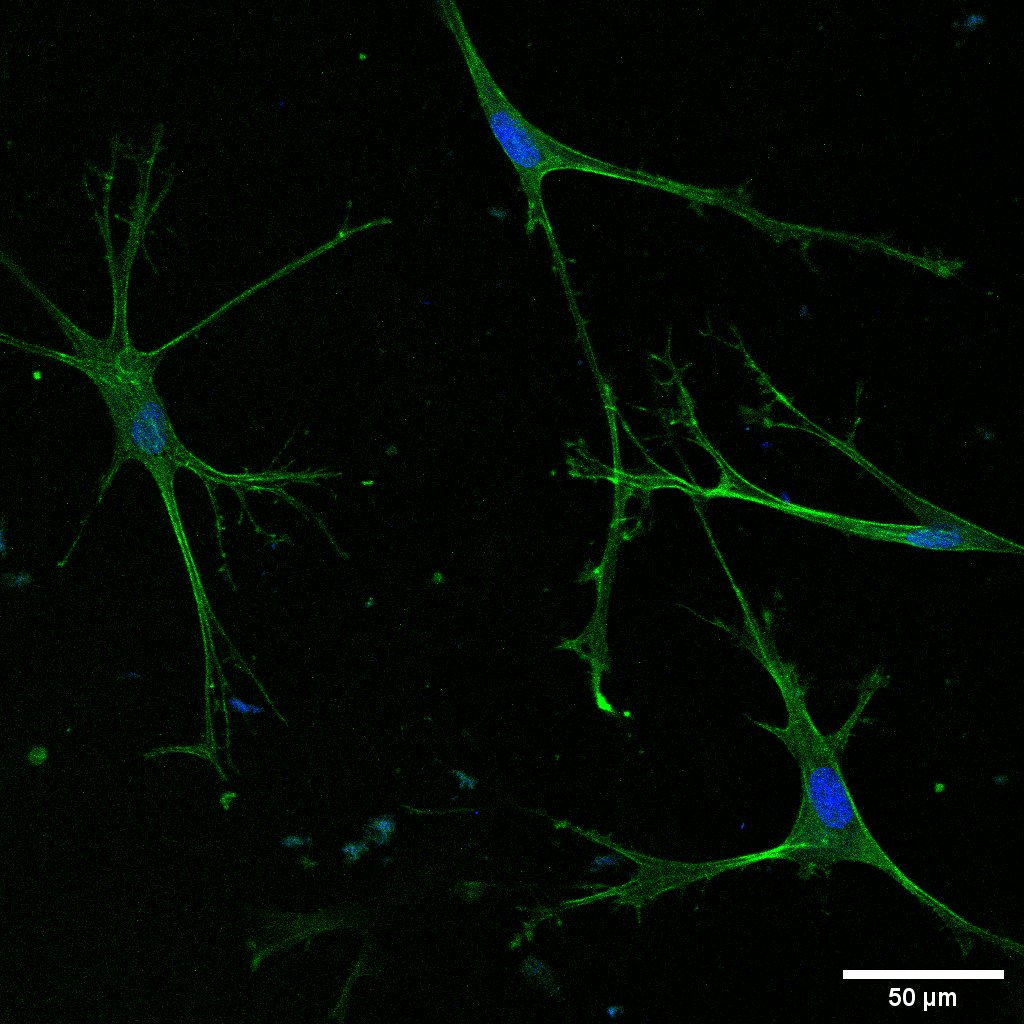 Osteoprotective effects of the neuropeptide VIP: insights from triple cultures of human osteocytes, osteoblasts, and osteoclasts