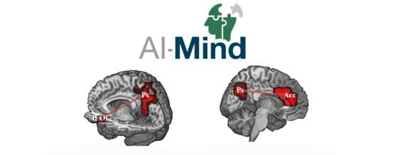 Inteligencia Artificial para detectar el Alzheimer