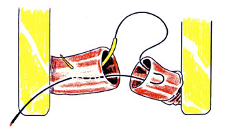 clip/inv10.jpg