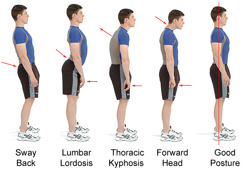 Los métodos fisioterápicos del tratamiento de la columna vertebral