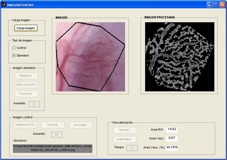 Tratamiento de una imagen de tejido vascular