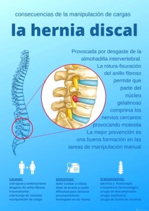 La hernia discal