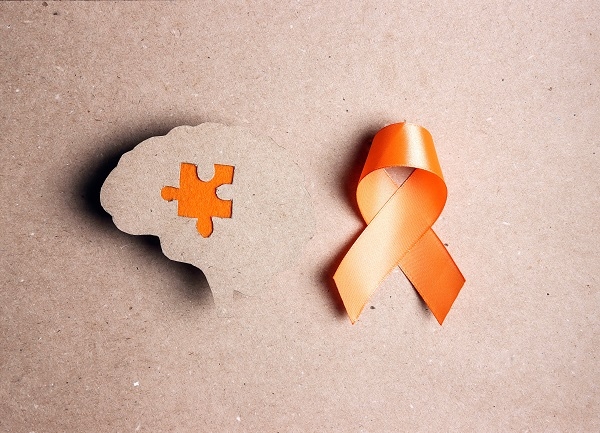 Se utiliza el color naranja para su representación. / Shutterstock.  