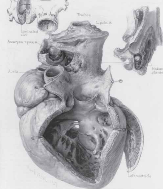 Ilustración de corazón de Max Brödel.
