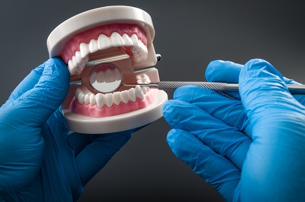 La mala salud periodontal es factor de riesgo en problemas de salud mental. / Shutterstock.