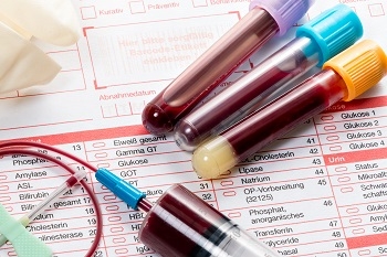 Los linfocitos T afectados viajan por la sangre. / Shutterstock.