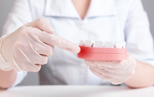 La periodontitis es una enfermedad inflamatoria de los tejidos que rodean el diente. / Valiantsin suprunovich. Shutterstock. 