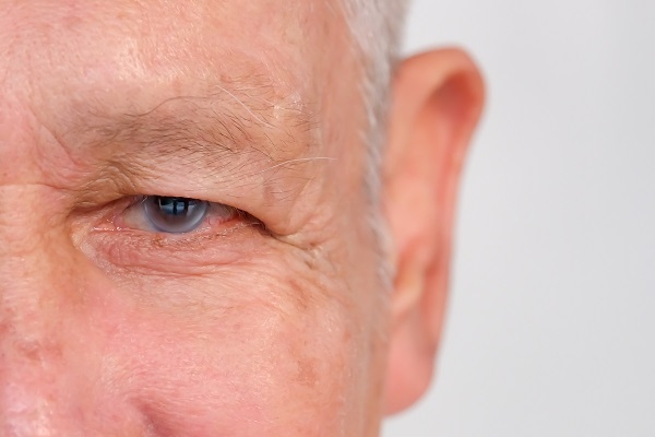 El glaucoma es una de las principales causas de ceguera en el mundo. / Shutterstock. 